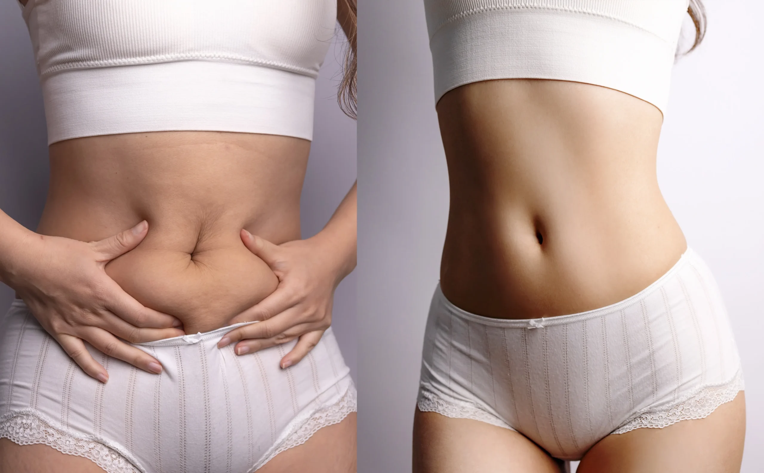 Before and after abdomen slimming showing a flatter stomach.